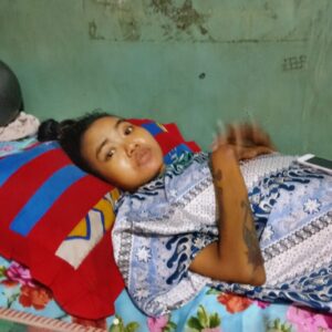 Pasca Operasi Caesar, Pasien RSUD Bekasi Lumpuh